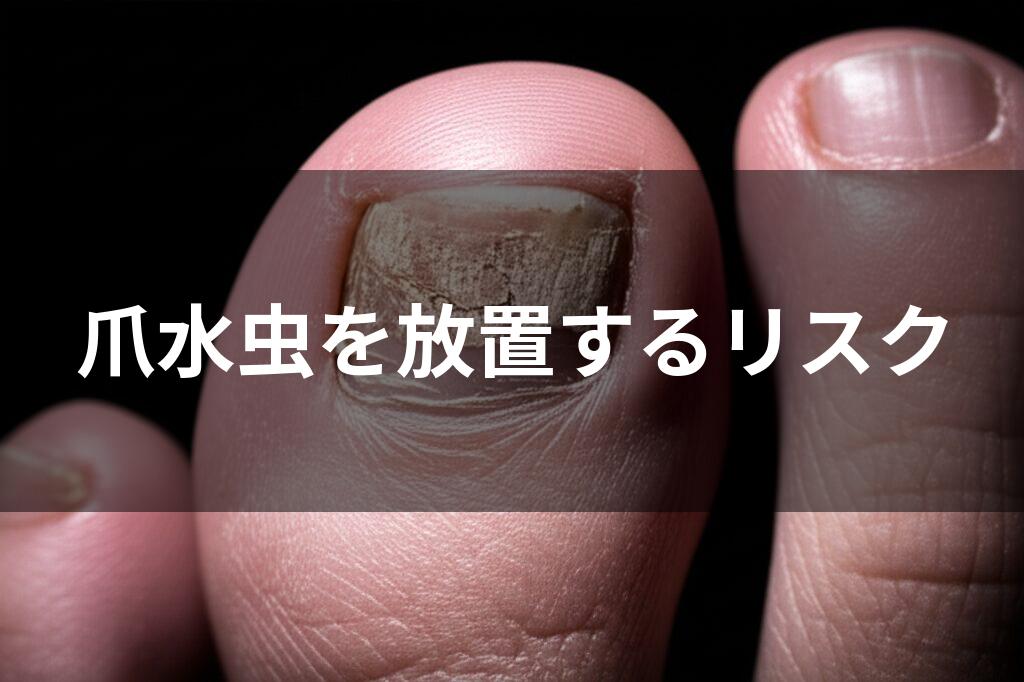 ひび割れて変色した足の爪